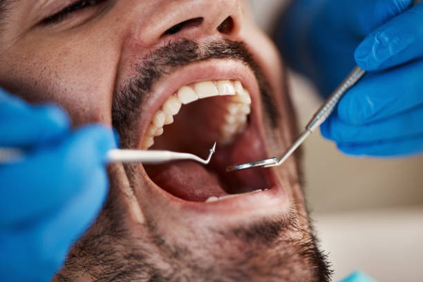 Best Tooth Pain Emergency Relief  in Berrien Springs, MI