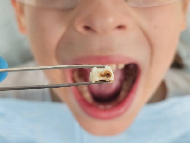Best Dentist for Tooth Abscess  in Berrien Springs, MI