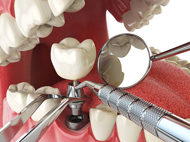 Best Knocked-Out Tooth Emergency  in Berrien Springs, MI